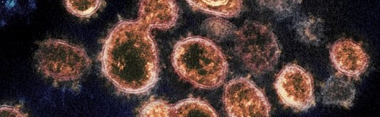 Coronavirus Threat Looms Large for Low-Income Cities